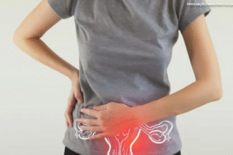 Endometriose: conheça mais sobre essa doença que afeta cerca de oito milhões de brasileiras