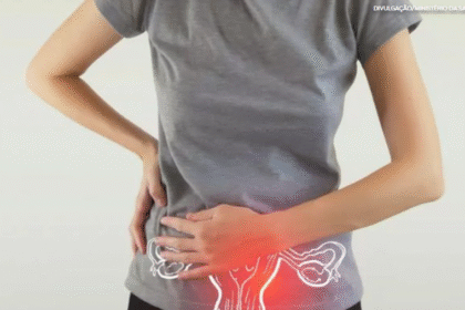 Endometriose: conheça mais sobre essa doença que afeta cerca de oito milhões de brasileiras