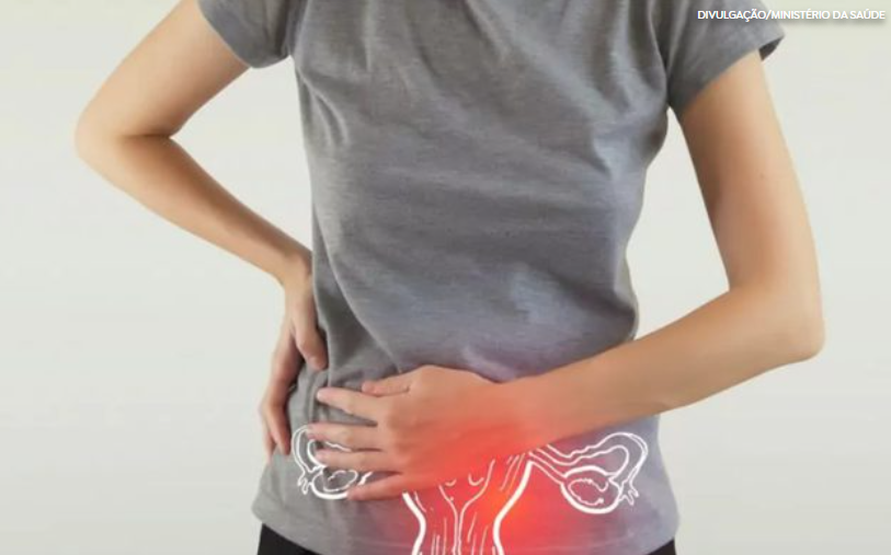 Endometriose: conheça mais sobre essa doença que afeta cerca de oito milhões de brasileiras