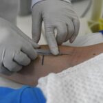 SES divulga nota reforçando vigilância e MS segue sem casos confirmados de hantavirose há 7 anos